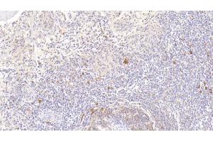 Immunohistochemistry (IHC) image for anti-Fatty Acid Binding Protein 3, Muscle and Heart (FABP3) (AA 1-133) antibody (ABIN7433315)