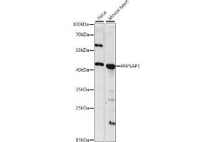 Western blot analysis of extracts of various cell lines, using PRPS antibody (ABIN7269364) at 1:1000 dilution. (PRPSAP1 Antikörper  (AA 30-110))