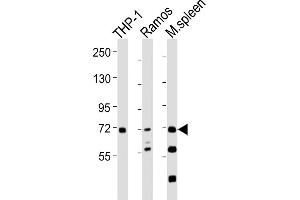 All lanes : Anti-SYK Antibody at 1:2000 dilution Lane 1: THP-1 whole cell lysates Lane 2: Ramos whole cell lysates Lane 3: mouse spleen lysates Lysates/proteins at 20 μg per lane. (SYK Antikörper  (AA 268-305))