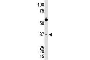 Image no. 1 for anti-DKK3 (N-Term) antibody (ABIN357071) (DKK3 Antikörper  (N-Term))
