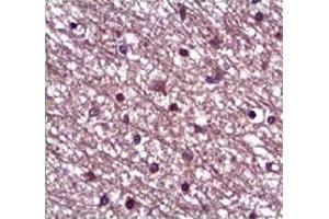 Immunohistochemical staining of formalin-fixed paraffin-embedded human heart showing staining with ANGPT1 polyclonal antibody  at 1:100 dilution.