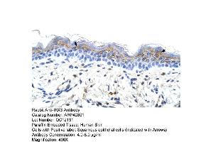 Human Skin (IRX3 Antikörper  (C-Term))