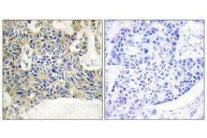 Immunohistochemistry (IHC) image for anti-Protein Kinase C, theta (PRKCQ) (pSer695) antibody (ABIN1847342) (PKC theta Antikörper  (pSer695))