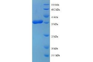 SDS-PAGE (SDS) image for Ribosomal Protein L38 (RPL38) (AA 2-70) protein (GST tag) (ABIN1607978)