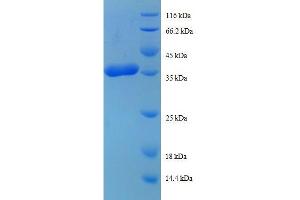 Ribosomal Protein L38 (RPL38) (AA 2-70) protein (GST tag)