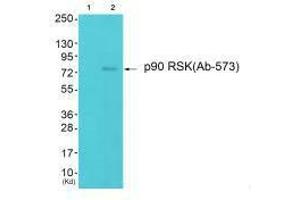 Western blot analysis of extracts from 293 cells (Lane 2), using p90 RSK (Ab-573) antiobdy. (RPS6KA1 Antikörper  (Thr573))