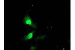 Anti-EXOSC7 mouse monoclonal antibody (ABIN2455516) immunofluorescent staining of COS7 cells transiently transfected by pCMV6-ENTRY EXOSC7 (RC201419). (EXOSC7 Antikörper)