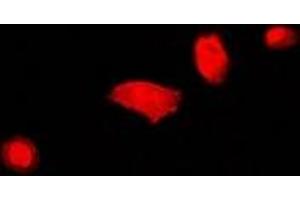 Immunofluorescent analysis of DCAF7 staining in U2OS cells. (DCAF7 Antikörper)