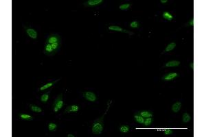 Immunofluorescence of monoclonal antibody to NEUROD6 on HeLa cell.