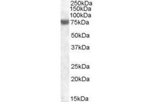 ABIN570909 (1µg/ml) staining of Human Heart lysate (35µg protein in RIPA buffer). (FEM1A Antikörper  (C-Term))