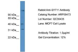 WB Suggested Anti-SYT11  Antibody Titration: 0.