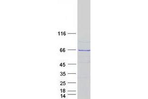 Western Blotting (WB) image for Fem-1 Homolog B (FEM1B) protein (Myc-DYKDDDDK Tag) (ABIN2721001)