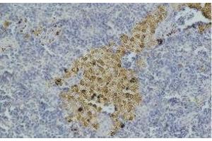 Immunohistochemistry of paraffin-embedded Mouse spleen tissue with CASP8 Monoclonal Antibody (Caspase 8 Antikörper)