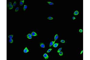 Immunofluorescent analysis of A375 cells using ABIN7146996 at dilution of 1:100 and Alexa Fluor 488-congugated AffiniPure Goat Anti-Rabbit IgG(H+L) (Cathepsin B Antikörper  (AA 82-333))