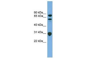 SH3KBP1 antibody used at 1 ug/ml to detect target protein. (SH3KBP1 Antikörper  (N-Term))