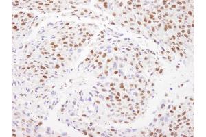 Immunohistochemistry (IHC) image for anti-Matrin 3 (MATR3) (C-Term) antibody (ABIN7448986)