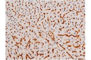 Immunohistochemistry (IHC) image for anti-Spleen tyrosine Kinase (SYK) (pTyr525) antibody (ABIN6255944)