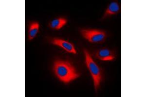 Immunofluorescent analysis of MKK1/2 (pS222/226) staining in K562 cells. (MEK1 Antikörper  (pSer222, pSer226))
