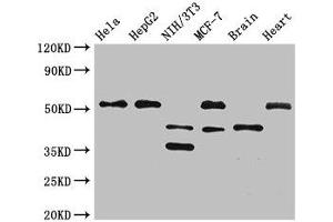 Western Blot Positive WB detected in: Hela whole cell lysate, HepG2 whole cell lysate, NIH/3T3 whole cell lysate, MCF-7 whole cell lysate, Mouse brain tissue, Rat heart tissue All lanes: LAX1 antibody at 2. (LAX1 Antikörper  (AA 107-298))