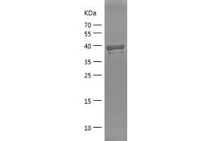 Western Blotting (WB) image for Eukaryotic Translation Initiation Factor 2A, 65kDa (EIF2A) (AA 432-585) protein (His-IF2DI Tag) (ABIN7122840) (EIF2A Protein (AA 432-585) (His-IF2DI Tag))