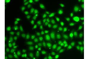 Immunofluorescence analysis of A549 cells using TXNL4B antibody (ABIN5974279). (TXNL4B Antikörper)