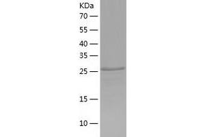 Western Blotting (WB) image for Fc Receptor-Like 6 (FCRL6) (AA 20-307) protein (His tag) (ABIN7287602) (FCRL6 Protein (AA 20-307) (His tag))