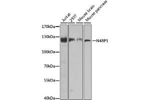 Western blot analysis of extracts of various cell lines, using N4BP1 antibody. (N4BP1 Antikörper)