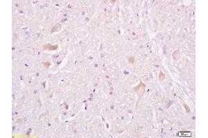 Formalin-fixed and paraffin embedded rat brain tissue labeled withAnti-Tuberin/TSC2 Polyclonal Antibody, Unconjugated (ABIN701200) at 1:200, followed by conjugation to the secondary antibody and DAB staining (Tuberin Antikörper  (AA 1601-1750))