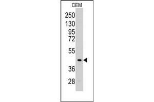 Image no. 1 for anti-Aldolase C, Fructose-Bisphosphate (ALDOC) (C-Term) antibody (ABIN357882) (ALDOC Antikörper  (C-Term))