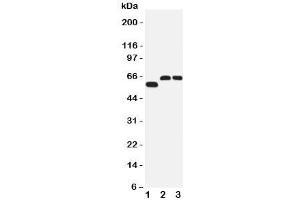 Western blot testing of SLC1A4 antibody and Lane 1:  human U87;  2: rat brain;  3: mouse brain tissue lysate.