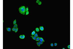 Immunofluorescent analysis of PC-3 cells cells using ABIN7146207 at dilution of 1:100 and Alexa Fluor 488-congugated AffiniPure Goat Anti-Rabbit IgG(H+L) (Cadherin 12 Antikörper  (AA 56-605))
