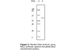 Image no. 1 for anti-ABL2 (ABL2) antibody (ABIN230671) (ABL2 Antikörper)