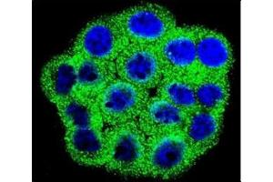 Immunofluorescence (IF) image for anti-Cyclin-Dependent Kinase Inhibitor 2B (p15, Inhibits CDK4) (CDKN2B) (AA 102-130) antibody (ABIN3030647)