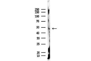 Western blot analysis of lysates from Rat lung, using KCNJ2 Antibody at 1/1000 dilution.