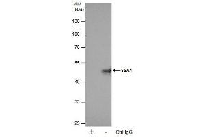 IP Image Immunoprecipitation of SSA1 protein from 293T whole cell extracts using 5 μg of SSA1 antibody [C1C3], Western blot analysis was performed using SSA1 antibody [C1C3], EasyBlot anti-Rabbit IgG  was used as a secondary reagent. (TRIM21 Antikörper)