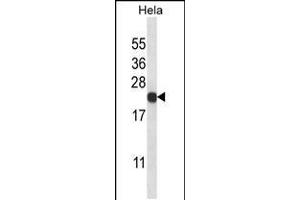 Western Blotting (WB) image for anti-Proteasome (Prosome, Macropain) Subunit, beta Type, 5 (PSMB5) (AA 235-263), (C-Term) antibody (ABIN5536411)