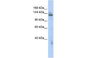 WB Suggested Anti-ZMYND8 Antibody Titration:  0. (ZMYND8 Antikörper  (Middle Region))