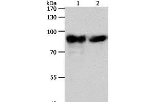Western Blot analysis of Mouse heart tissue and hela cell using ACO2 Polyclonal Antibody at dilution of 1:400 (ACO2 Antikörper)