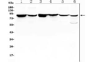 Western blot analysis of RDX using anti-RDX antibody (ABIN7602767). (Radixin Antikörper  (C-Term))