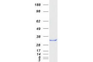 Validation with Western Blot (RANBP1 Protein (Myc-DYKDDDDK Tag))