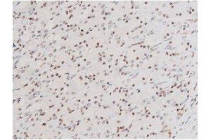 Immunohistochemistry (IHC) image for anti-Spleen tyrosine Kinase (SYK) (pTyr525) antibody (ABIN6255944)