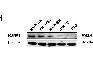 Identification of RUNX1 as an apoptosis transcription factor and an independent prognostic factor in NB tissue and cell lines. (RUNX1 Antikörper  (AA 221-480))