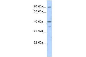 WB Suggested Anti-OAS1 Antibody Titration:  0. (OAS1 Antikörper  (Middle Region))