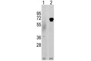 Western blot analysis of CAMKK2 antibody and 293 cell lysate either nontransfected (c) or transiently transfected with the CAMKK2 gene (2). (CAMKK2 Antikörper  (AA 52-82))