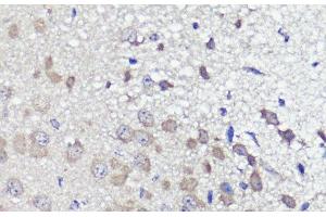 Immunohistochemistry of paraffin-embedded Mouse brain using UBL3 Polyclonal Antibody at dilution of 1:100 (40x lens). (UBL3 Antikörper)