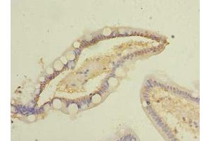 Immunohistochemistry of paraffin-embedded human small intestine tissue using ABIN7148320 at dilution of 1:100 (COMMD9 Antikörper  (AA 1-198))