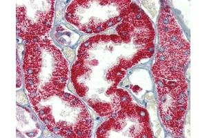 SH3BP2 antibody was used for immunohistochemistry at a concentration of 4-8 ug/ml. (SH3BP2 Antikörper  (Middle Region))
