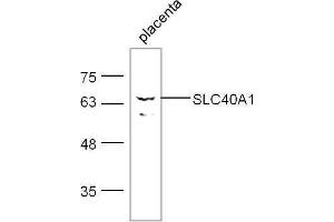 Mouse placenta lysates probed with Rabbit Anti- Polyclonal Antibody, Unconjugated  at 1:500 for 90 min at 37˚C. (SLC40A1 Antikörper  (AA 331-430))