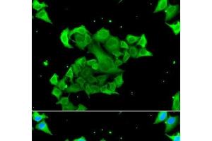 Immunofluorescence analysis of A549 cells using Rad51D Polyclonal Antibody (RAD51D Antikörper)