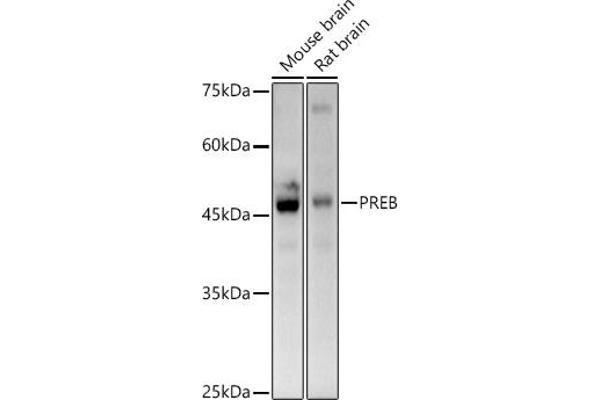 PREB anticorps